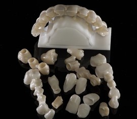 protezy, implanty Warszawa Wesoła